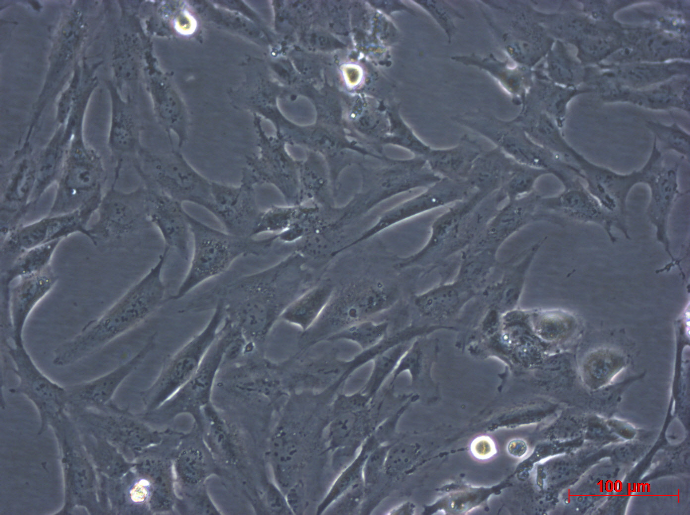 hFOB 1.19细胞图片